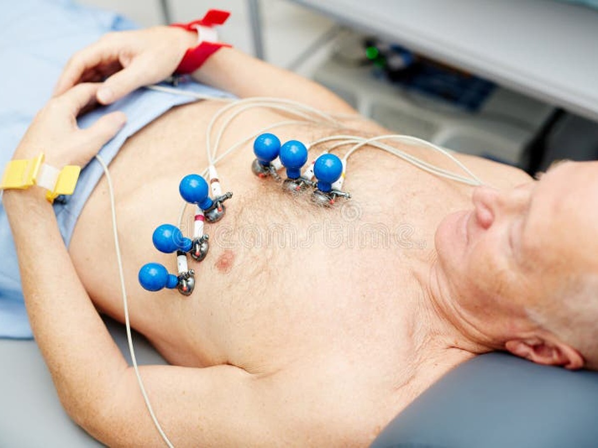 Electrocardiogram (ECG) Testing