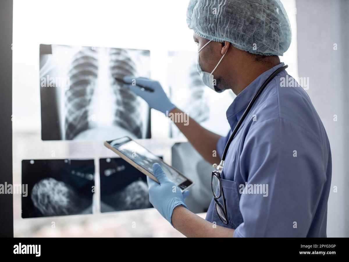 Lung Chest X-Rays
